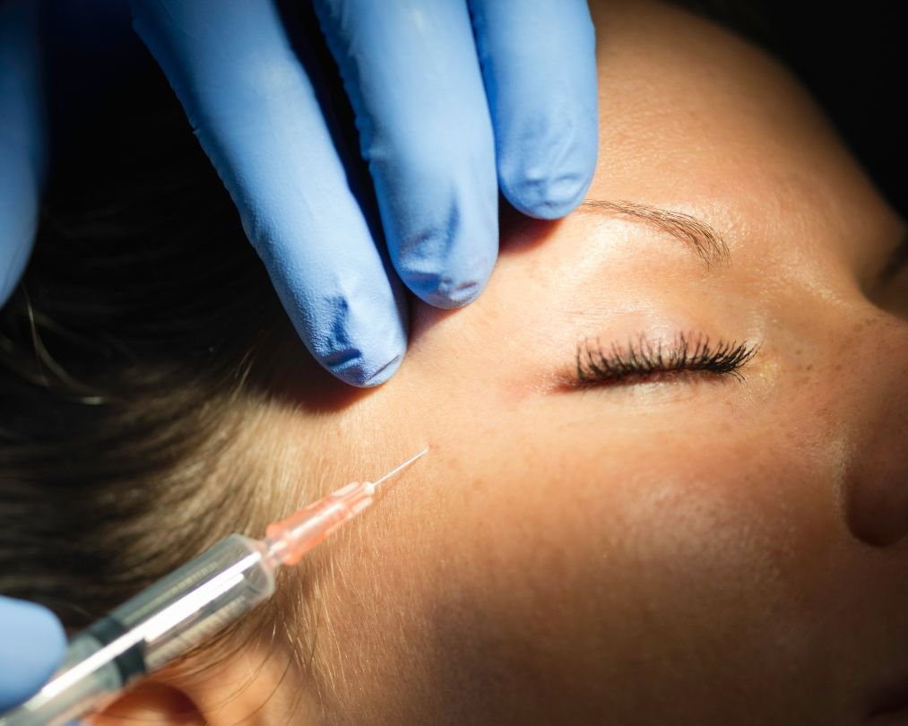 Botox caseiro imediato